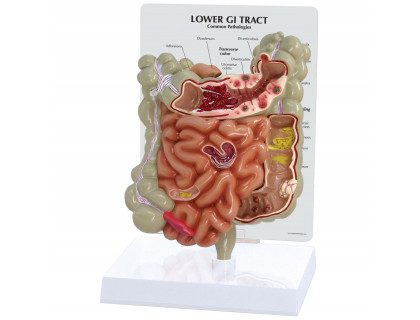 Model gastrointestinálneho traktu
