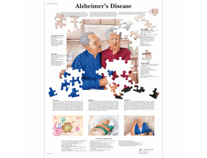 Obraz Alzheimerova choroba 50x67cm
