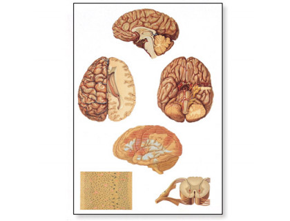 Obraz Centrálny nervový systém