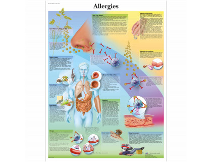 Obraz Ľudské alergie 50x67cm