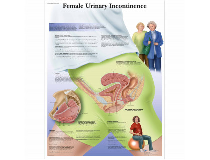 Obraz Ženská močová inkontinencia 50x67cm