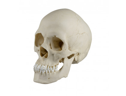 Model skafocefalická lebka