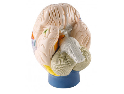 Model mozgu neurologický  - 4 dielny 