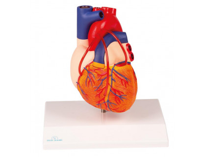 Model ľudského srdca s bypassom