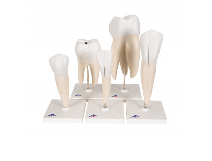 Model zubov 5 verzií