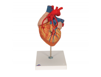 Model srdca s bypassom,4 časti