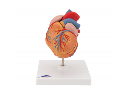 Model srdca s hypertrofiou ľavej komory,2 časti