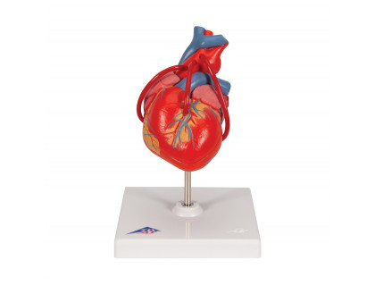 Model srdca s bypassom,2 časti