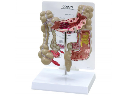 Model hrubého čreva