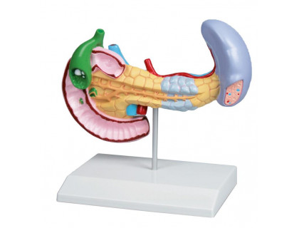 Model ochorenie pankreasu,sleziny a žlčníka