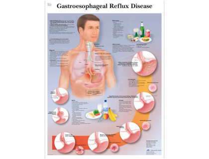 Obraz Gastroezofageálna refluxná choroba 50x67cm