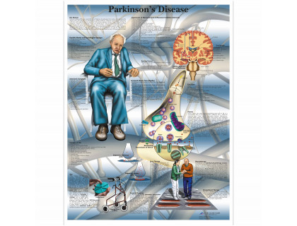 Obraz Parkinsonova choroba 50x67cm