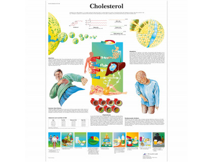 Obraz Cholesterol 50x67cm