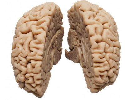 Model ľudský mozog žena skutočný odliatok 