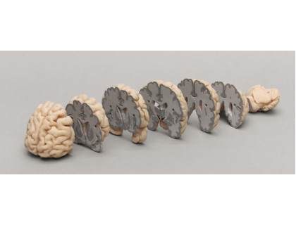 Set čelných prierezov ľudského mozgu