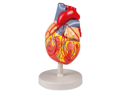 Model ľudského srdca s bypassom 2 krát zväčšený,2 časti