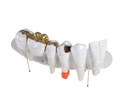Model ľudských zubov-10x zväčšené,7 častí