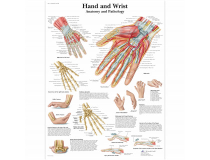 Obraz Ruka a zápästie – anatómia a patológia 50x67cm