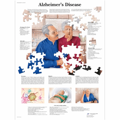 Obraz Alzheimerova choroba 50x67cm
